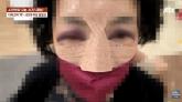 80대 여성 코뼈 부러졌는데 '집유'... 가해자 아빠 '아들이 누굴 때려 죽이고 그럴 정도 아냐'