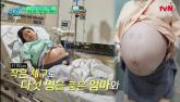6,500만 분의 1 확률로 '오둥이 자연임신' 한 여성 '선택적 유산 권유받기도'