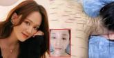 '허리 가늘어져'... 주기적으로 온 몸에 실침 '100개씩' 맞는다는 대만 여배우
