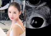 당당하게 '혼전임신' 발표한 나솔 16기 옥순... '임신 노하우 알려드릴게요'
