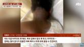 국내 카드사 광고 찍다 목 부러진 외국인 모델... '사고는 불운... 우리 과실 없어'